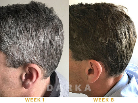 Anti-Greying Hair Serum