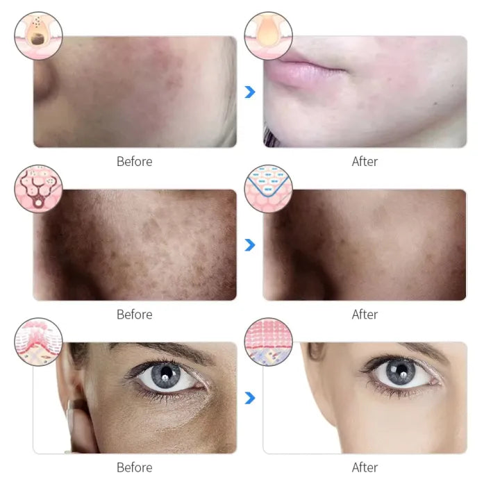 LED 7 Color Face Mask – Skin Rejuvenation & Anti-Acne Therapy
