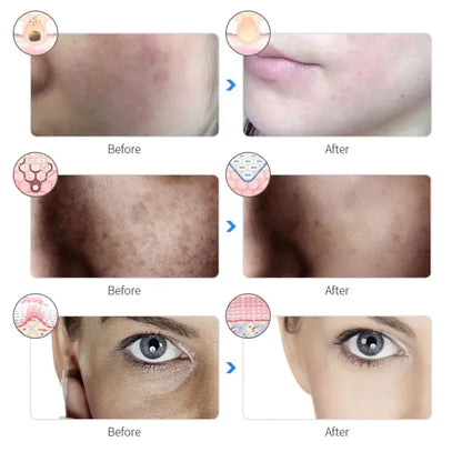 LED 7 Color Face Mask – Skin Rejuvenation & Anti-Acne Therapy