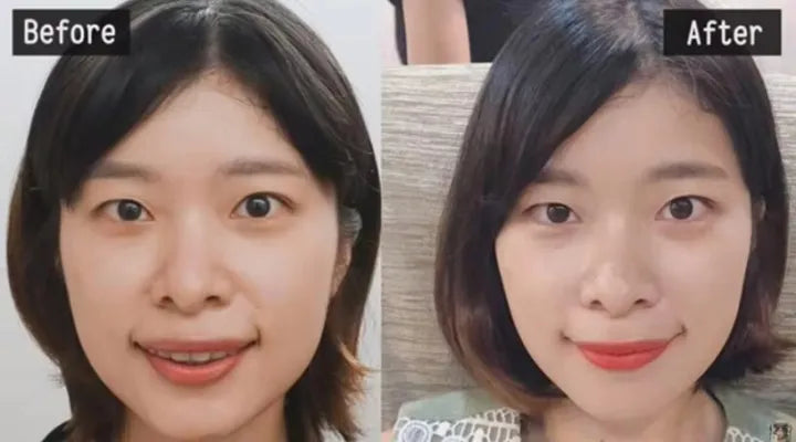 Face Slimming Jawline Trainer