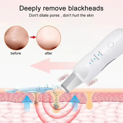 Ultrasonic Skin Scrubber