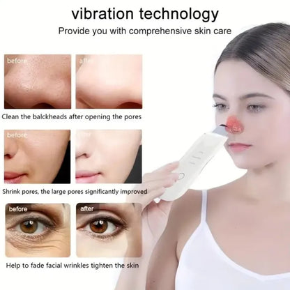 Ultrasonic Skin Scrubber
