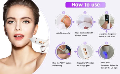 Laser Mole & Dark Spot Removal Pen