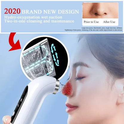 Hydra Facial Pore Vacuum Cleaner