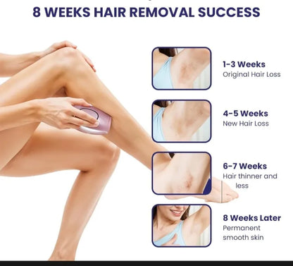 IPL Laser Hair Removal Device – Smooth Skin at Home